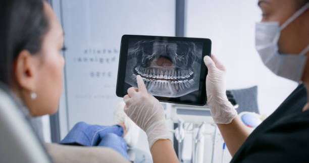 Licensed Tooth Extraction service in Dallas, TX - Smile Center Dentistry
